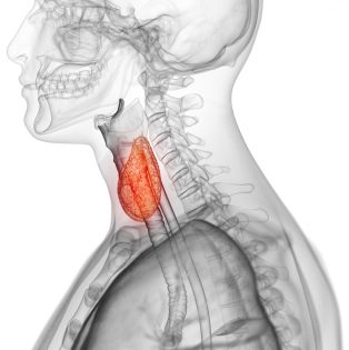 hypothyreose