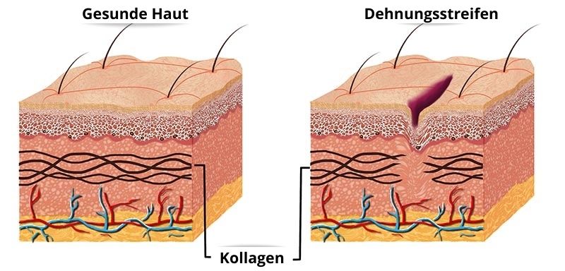 Gesunde Haut-Kollagen