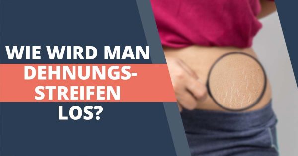 Dehnungsstreifen entfernen? Versuche diese Tricks!